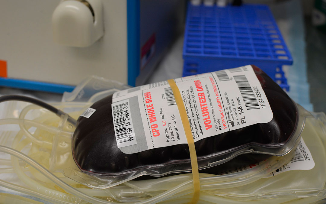 extraccion-sangre